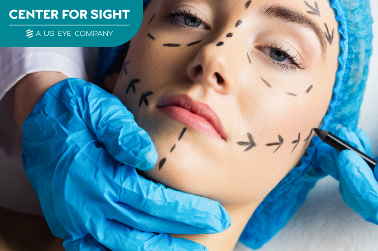 facelift surgery